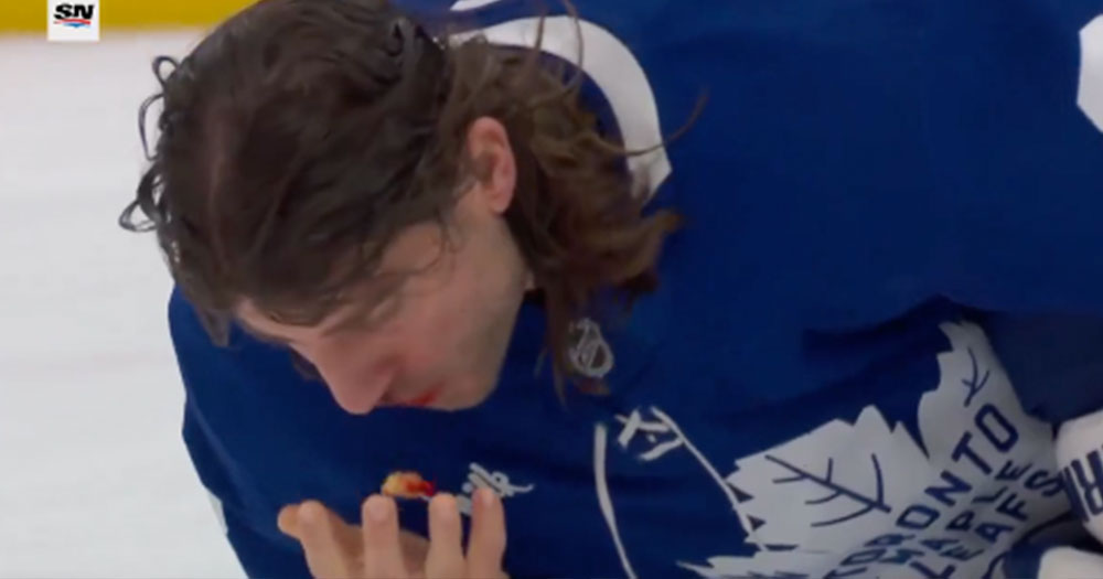 Chris Tanev blocks a shot with his face, spits out mouthful of teeth!