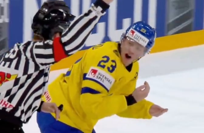 Lucas Raymond forced to pick up his own teeth! 