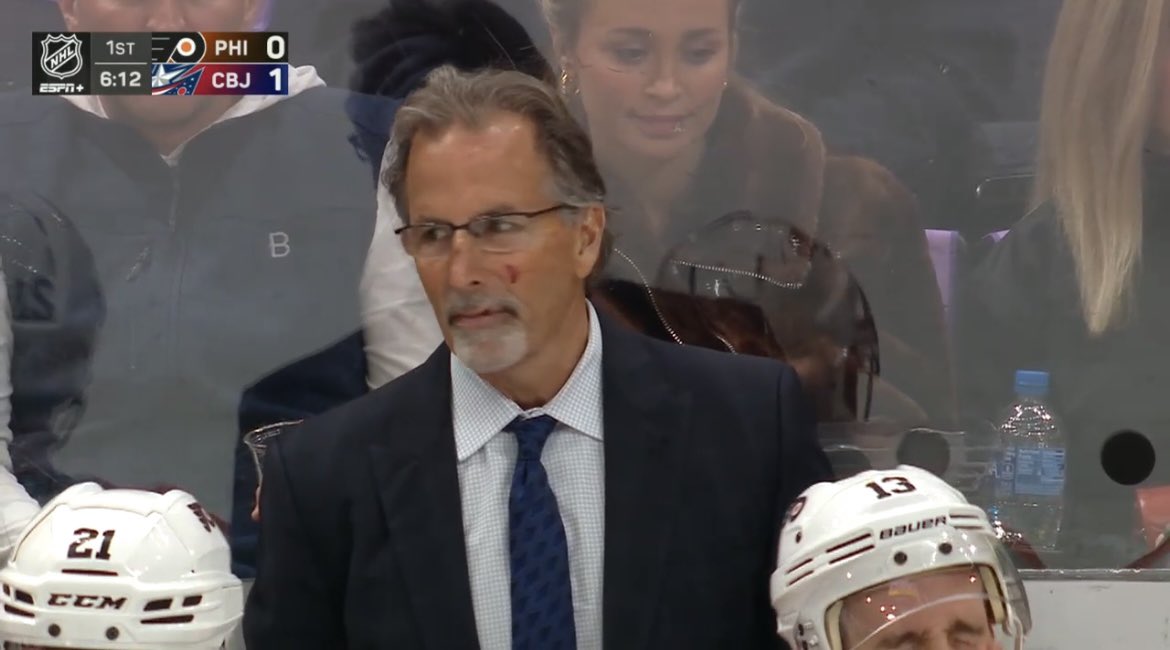 Hilarious theories emerge from John Tortorella’s brutal facial injury 