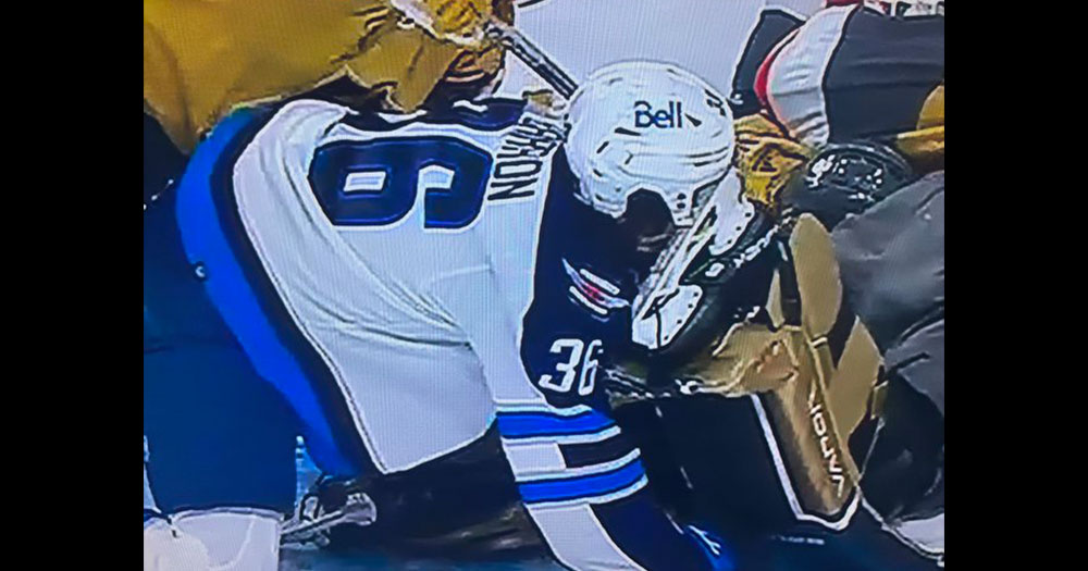 Barron goes face first into skate, gets cut wide open