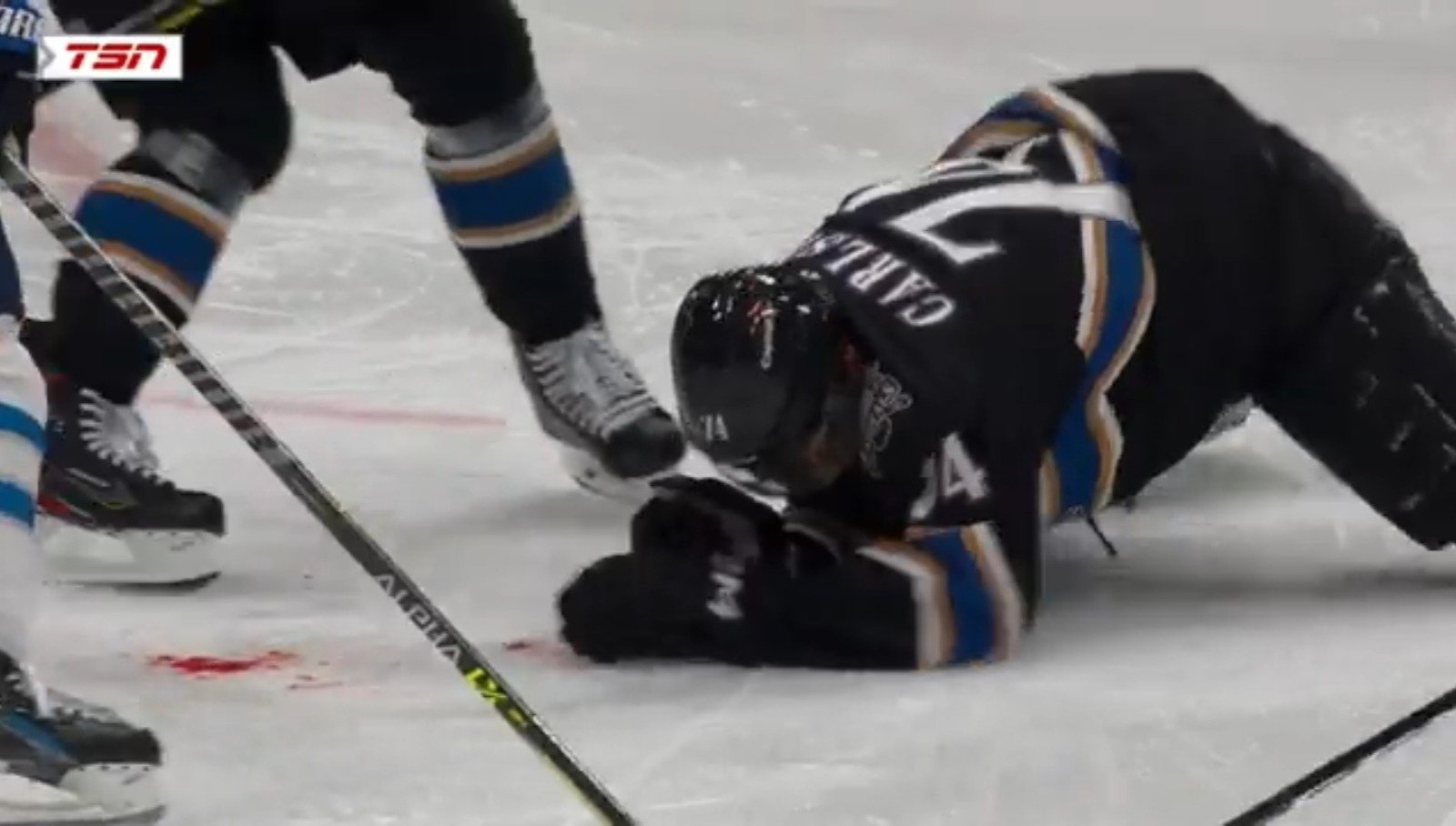 Scary details emerge from John Carlson’s gruesome facial injuries