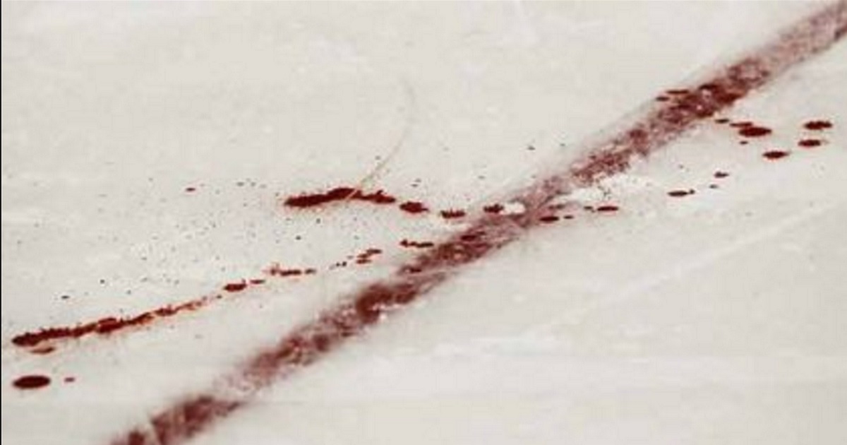 Arena evacuated after former NHLer takes a skate to the neck.