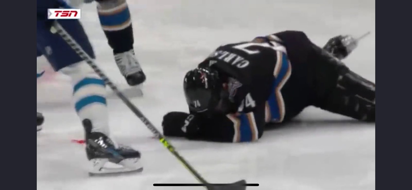 SCARY: John Carlson takes slapshot to the face