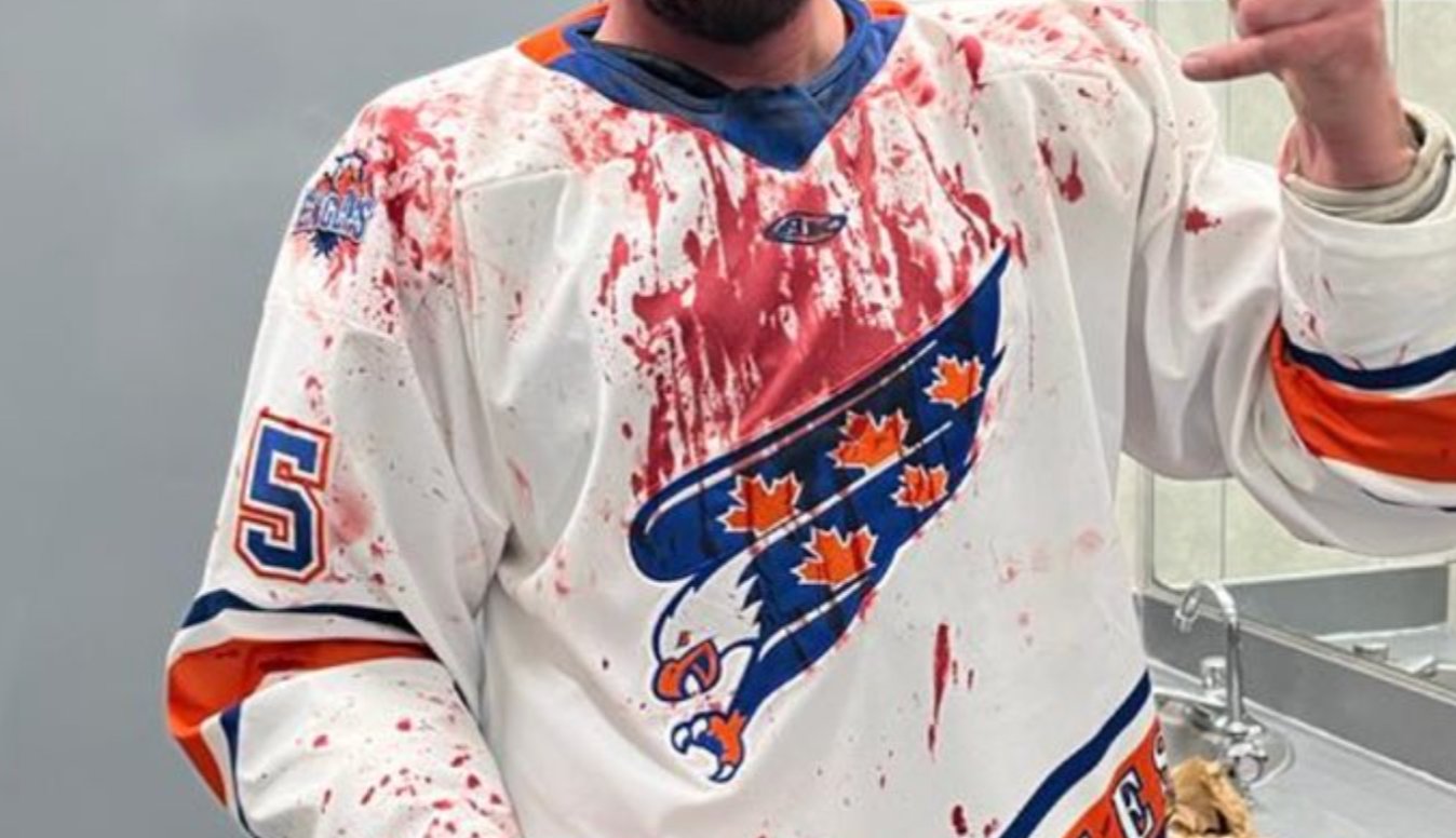 Shockingly bloody fight in ECSHL goes viral 