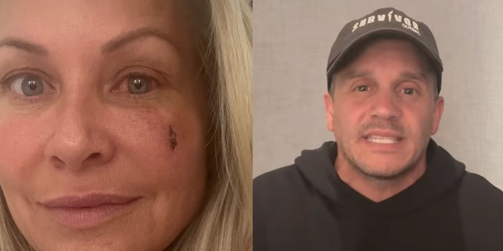Bouleversée, une participante de Survivor Québec donne des nouvelles suite à son accident