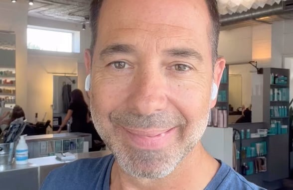 José Gaudet montre le résultat de sa greffe de cheveux