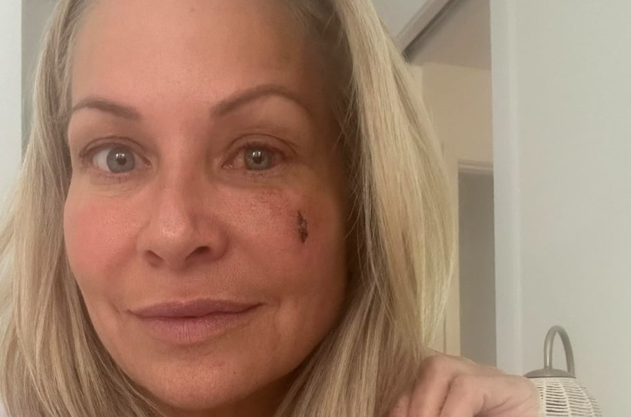 Katherine Huet atteinte de graves séquelles après sa blessure à survivor québec