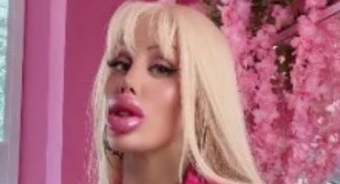 Une femme dépense plus de 200 000$ pour devenir « la Barbie humaine » et ne laisse personne indifférent 
