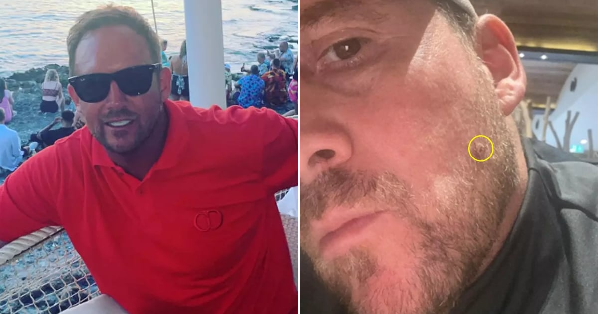 Un homme qui croyait avoir un poil incarné découvre que sa vie est peut-être en danger.