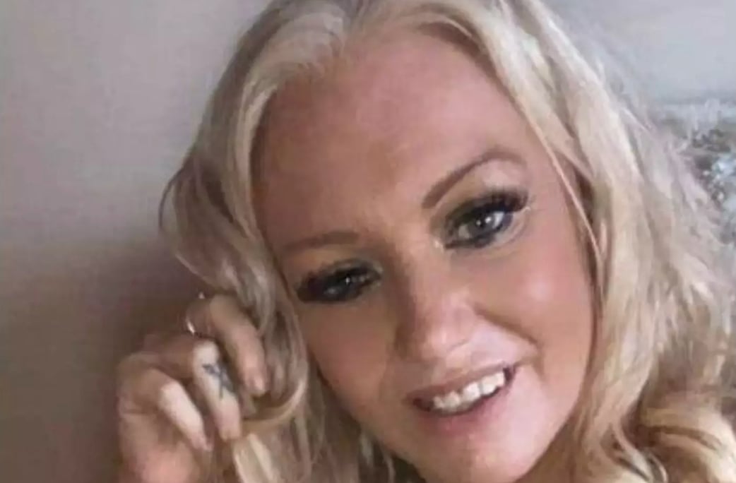 Une femme se fait dévisager par un chien-saucisse qui l'a attaquée 